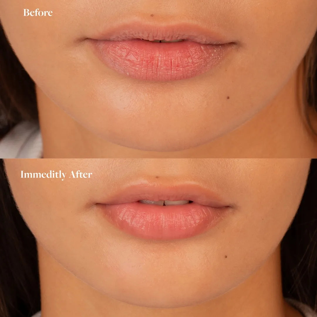 Hydrating Lip Mask & Balm