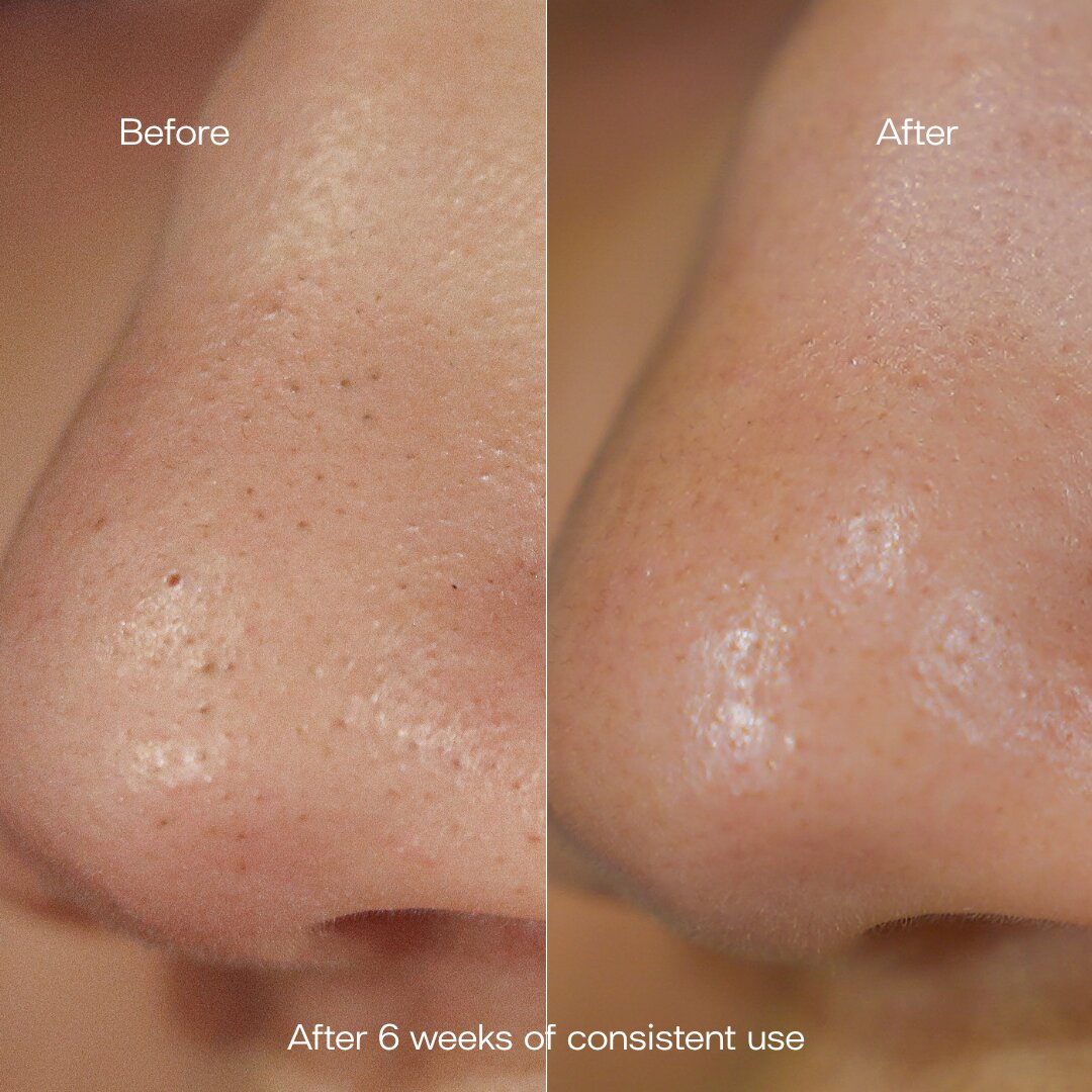 Hydrating Exfoliant Toner